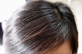 为啥白头发会越长越多？别以为自己老了，或是由于缺乏3种营养图片