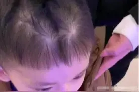 孩子头顶上的“旋”，代表什么意思？很多父母还不清楚，不妨了解图片