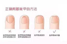 给宝宝剪指甲，方的对还是圆的好？大部分妈妈都做错了图片