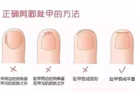 给宝宝剪指甲，方的对还是圆的好？大部分妈妈都做错了图片