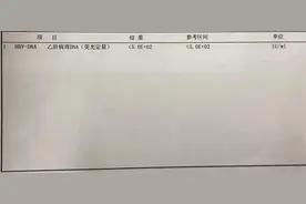 辟谣：HIV DNA小于参考值，代表没有乙肝病毒？医生：见于3种情况图片
