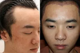 华晨宇被曝植发整容，十年容貌变化对比，锥子脸五官越来越精致图片