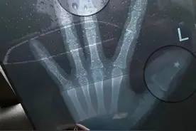 手机进水，插米缸里能抢救？没！用图片