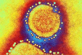 温故知新｜2016年上海首例人感染H7N9禽流感诊疗始末图片