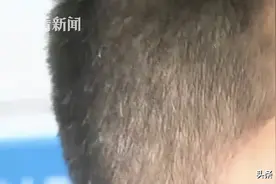 为治白发，小伙听信“土方”，吃了它整个人变成“小黄人”图片