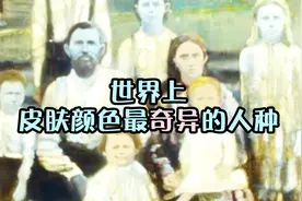 世界上还有蓝种人？全身皮肤是蓝色，既聪明行动又敏捷，世界罕见视频封面