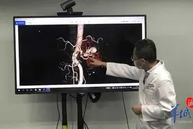 独肾上长了一串动脉瘤，看他们速冻肾后如何摘瘤保肾？图片