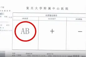 儿子身患肝癌，母亲欲割肝救子却发现不是亲生，肝癌换肝有用吗？图片