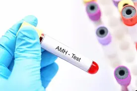 AMH数值不是越高越好图片