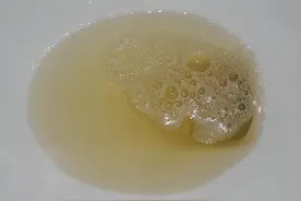 有泡沫尿就是肾脏出现问题了吗？医生坦言：这可不一定图片