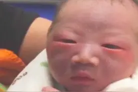 父母皮肤白，却生下“黑宝宝”，宝宝肤色太黑多半跟这些因素有关图片