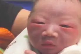 父母皮肤白，却生下“黑宝宝”，宝宝肤色太黑多半跟这些因素有关图片