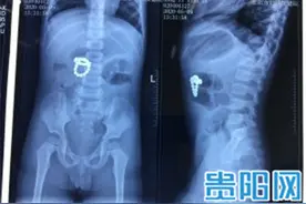 家长们请注意！又是这个“玩具”，危害太大差点闯大祸图片