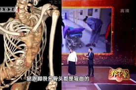 60岁后，你的骨骼可能正在“散架”！一吃一动，补营养，强骨骼图片