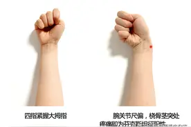 提重物、抱孩子，手腕疼痛难忍？几个小动作，帮你检测“妈妈手”图片