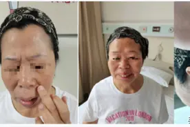 哈市第一医院微血管减压术让患者重绽笑容图片