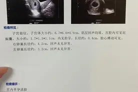 建档医院如何选？妇产医院还是综合医院图片