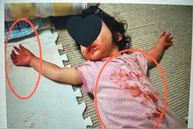宝妈出门不久，回家后看到3岁女儿躺在“血泊”中，顿时崩溃痛哭图片
