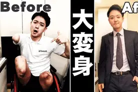超励志！29岁日本帅哥因事故失去手脚，却治愈了百万网友图片