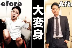 超励志！29岁日本帅哥因事故失去手脚，却治愈了百万网友图片