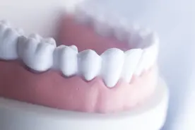 牙周炎，先洗牙再刮治图片