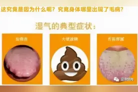 热水泡脚加一物，逼出体内湿气，可惜很少人知道！图片