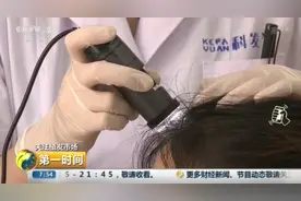 发际线越来越高该咋办？洗发水、生发仪真能有效治疗脱发？别被骗了图片
