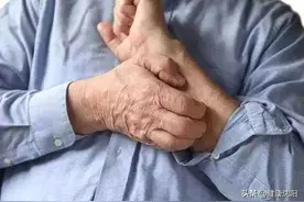 健康科普堂 | 荨麻疹反复不愈，是没管住嘴？浅谈荨麻疹的发病原因图片