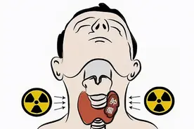 甲状腺癌切一半就一定会复发吗？张主任回答：不一定图片