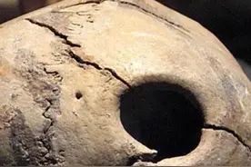 一颗5000年前的头颅被开了洞，是高超的中医，还是野蛮的祭祀图片