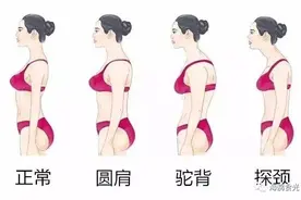 上斜方肌太发达导致圆肩驼背肩颈疼痛，一个瑜伽动作帮你全搞定图片