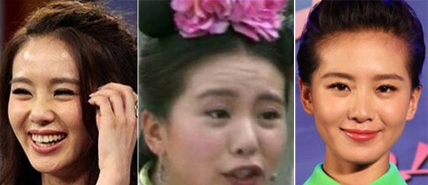 女人一直吃胶原蛋白 2026年女人一直吃胶原蛋白有用吗