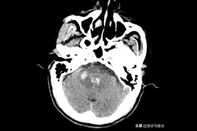 九死一生，不给你生的机会图片