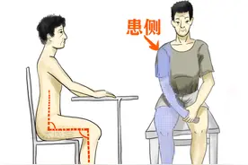 脑卒中患者偏瘫常见问题「来看看你知道」？图片