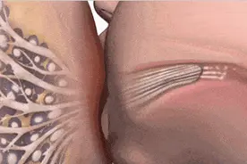 起早贪黑的吸奶还得乳腺炎，医生为你科普：究竟是哪里错了图片