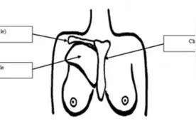 乳房出现这种疼痛一定要注意图片