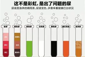 尿液的颜色与疾病图片