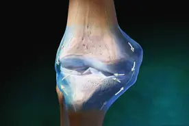 膝盖疼的不敢动，做核磁没有积液，是滑膜炎吗？医生帮您分析下图片