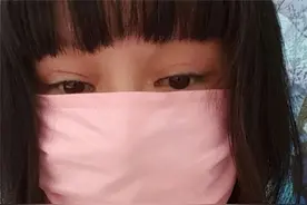 整容狂人红粉宝宝，200多次手术花费400多万，如今并发症危及生命图片