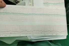 罕见孕晚期羊膜腔内出血 成都市一医院产科“教科书”式处置让产妇转危为安图片