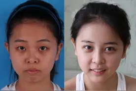 烟酰胺真的那么神奇吗？图片