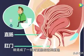 便秘、腹胀......“疝”小也有大麻烦，这类人群高发，易被误诊，别不当回事图片