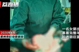 “哪吒”降世？女婴出生如透明巨蛋，医生：胎膜护体图片