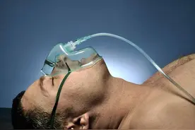 世界镇痛日：麻醉，到底是一种怎样的体验？会让你一秒变白痴吗？图片