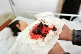 家中、办公室最常见！这种椅子会突然爆炸，有人被炸飞！已发生多起，赶紧自查图片