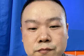 36岁的岳云鹏晒自拍照，满脸汗水想要减肥，网友还帮他瘦脸了图片
