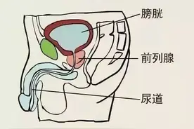 前列腺的“爆菊花”指检法图片