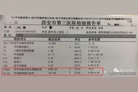 不需“消炎”的炎症｜桥本氏甲状腺炎图片