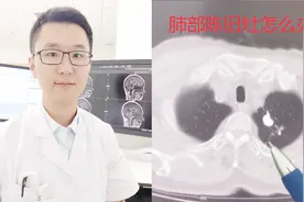 肺部CT检查发现肺部条索灶，陈旧灶究竟是什么？视频封面