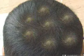 孩子头顶的“旋”，暗藏什么玄机？别迷信，科学的解释家长要悉知图片